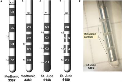 Deep Brain Stimulation: Emerging Tools for Simulation, Data Analysis, and Visualization